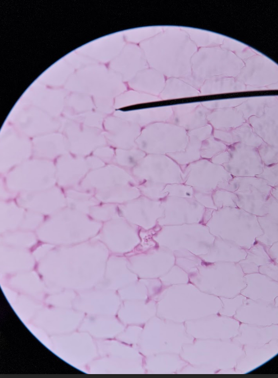 <p>empty spaces → plasma membrane is what stained rather than the actual cell</p><ul><li><p>emptier than the lung tissue</p></li></ul><p></p>