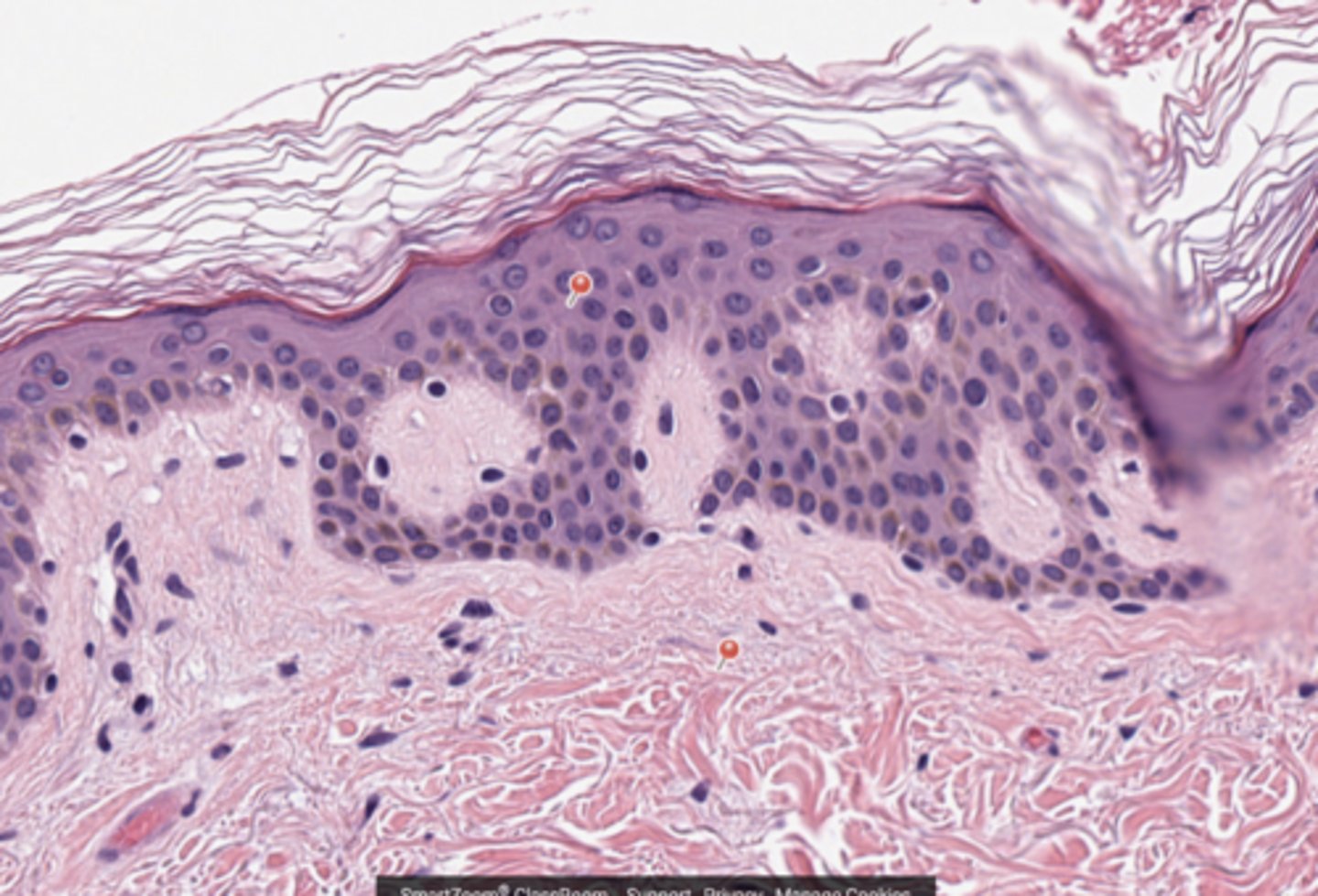 <p>Skin</p>
