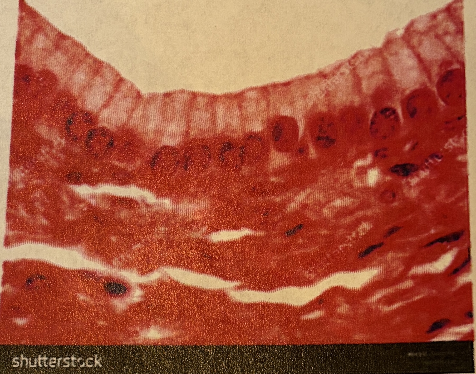 <p>simple columnar- special features</p>