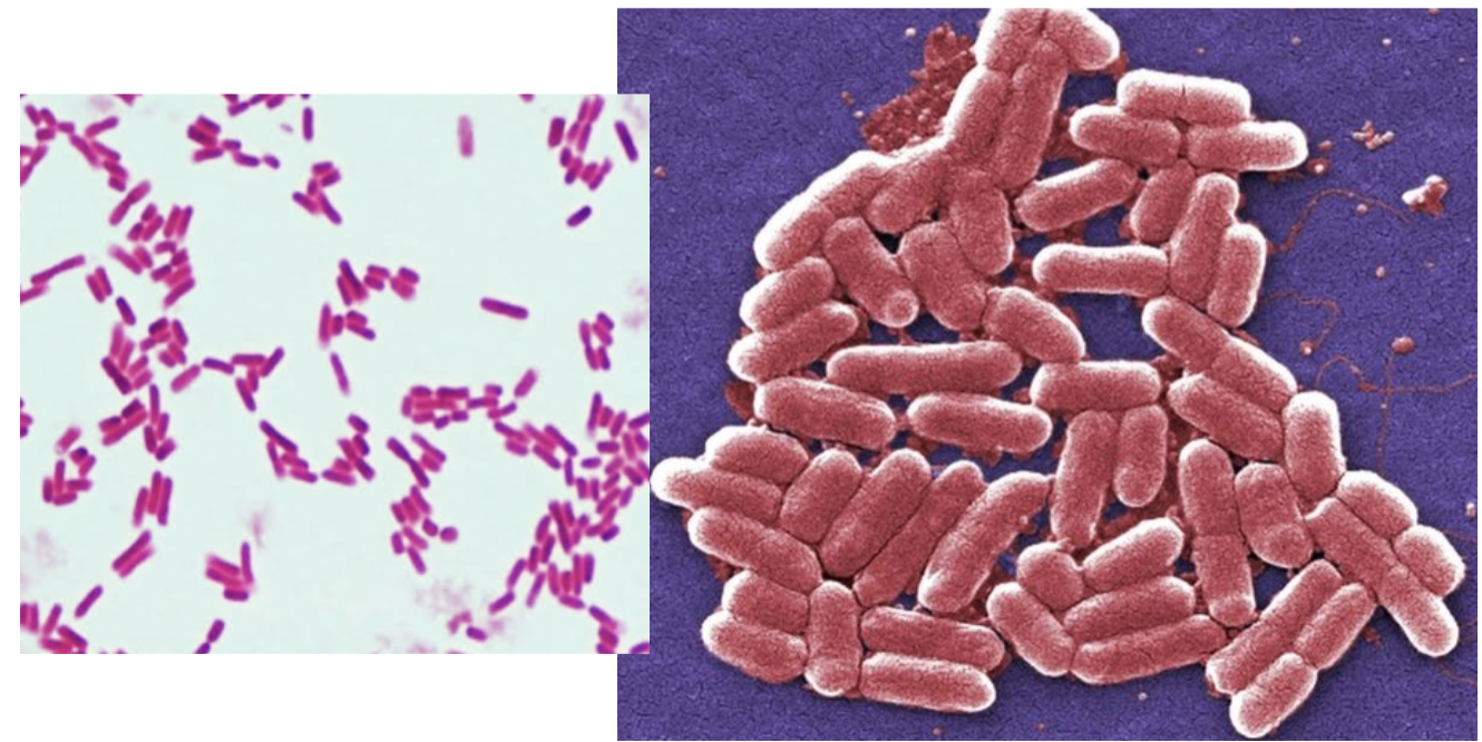 <p>Gram positive or gram negative bacteria?</p>