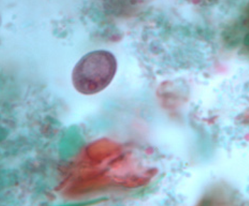 <p>Identify the organism and stage</p>