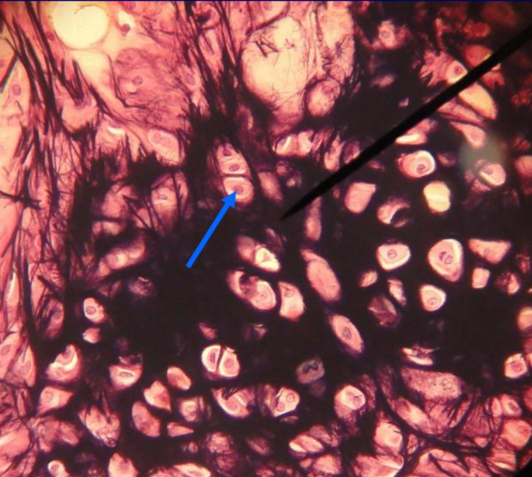 <p>What CELL is the arrow pointing to?</p>