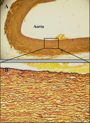 What is the stain being used in this slide