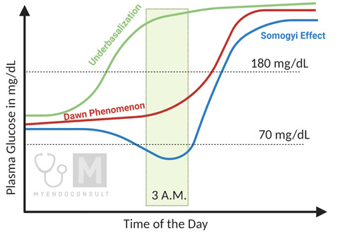 <p>Dawn Phenomenon - early morning episodes of hyperglycemia (with 3am elevated)<br>TX - limit carbs at bedtime, exercise after dinner, adjust/increase basal insulin or consider continuous insulin</p><p>Somogyi effect - nocturnal hypoglycemia leads to rebound AM hyperglycemia (S shape) with a reduced 3 am glucose<br>TX - reducing bedtime basal insulin dose, or have a bedtime snack<br></p><p></p>