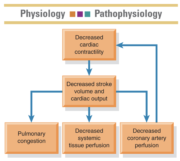 <p><span>Impairment or failure of the myocardium</span></p>