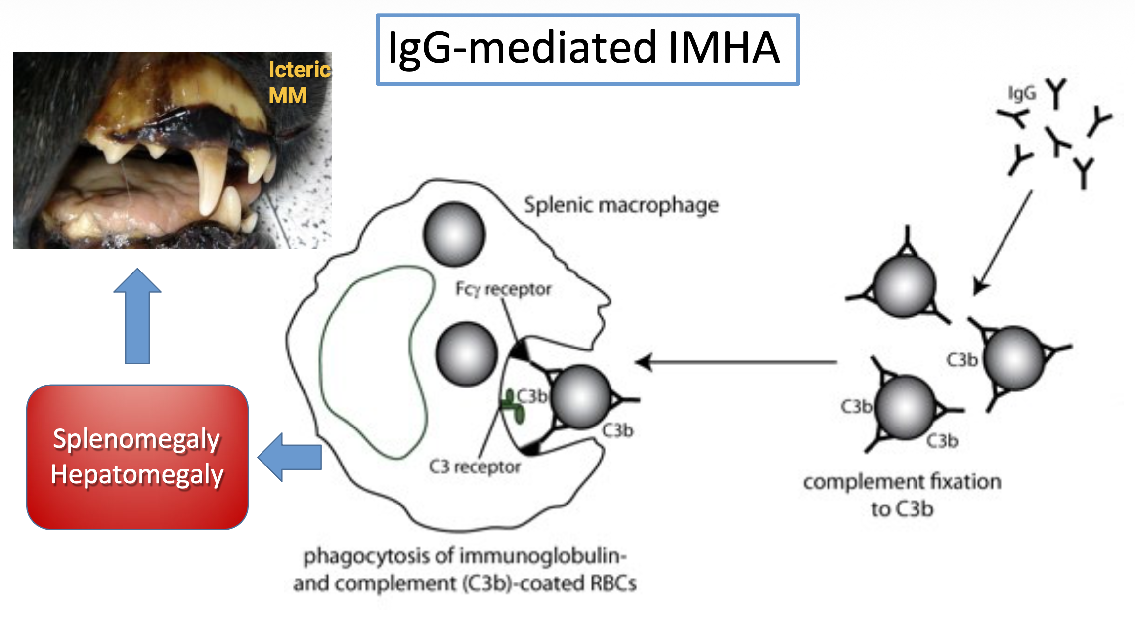<ul><li><p><strong>icteric</strong> MM</p></li><li><p>IgG → ↓ agglutination → <strong>phagocytosis</strong> by splenic macrophages → <strong>splenomegaly &amp; hepatomegaly</strong></p><ul><li><p>high RBC breakdown → increased bilirubin</p></li></ul></li></ul><p></p>