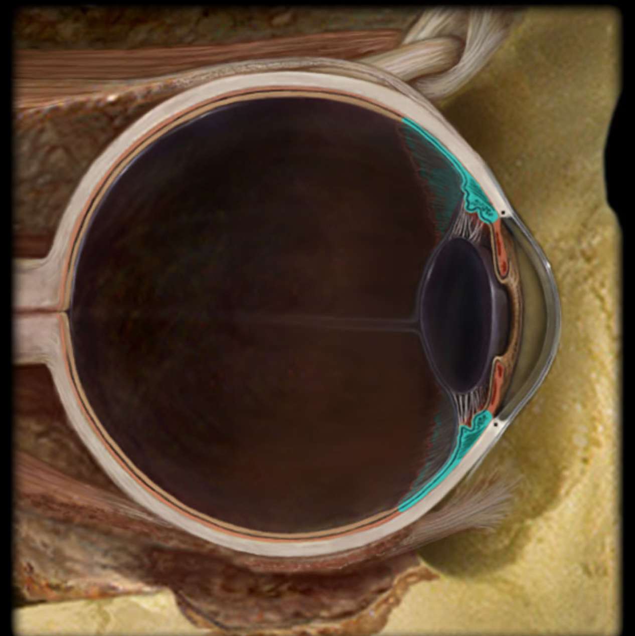 <h4 collapsed="false" seolevelmigrated="true"><strong>Location:</strong></h4><ul><li><p>Eye</p></li><li><p>Part of vascular (middle) layer, between choroid and iris</p></li></ul><h4 collapsed="false" seolevelmigrated="true"><strong>Description:</strong></h4><ul><li><p>Composed of ciliary muscle and ciliary processes</p></li></ul><h4 collapsed="false" seolevelmigrated="true"><strong>Function:</strong></h4><ul><li><p>Anular ciliary smooth muscle controls tension of suspensory ligaments to adjust thickness of lens</p></li><li><p>Ciliary processes produce aqueous humor</p></li></ul><h4 collapsed="false" seolevelmigrated="true"><strong>Comment:</strong></h4><ul><li><p>Aqueous humor produced by ciliary processes flows from posterior <em>chamber</em> to posterior chamber of anterior cavity where it is resorbed into venous system through the scleral venous sinus (canal of Schlemm)</p></li></ul>