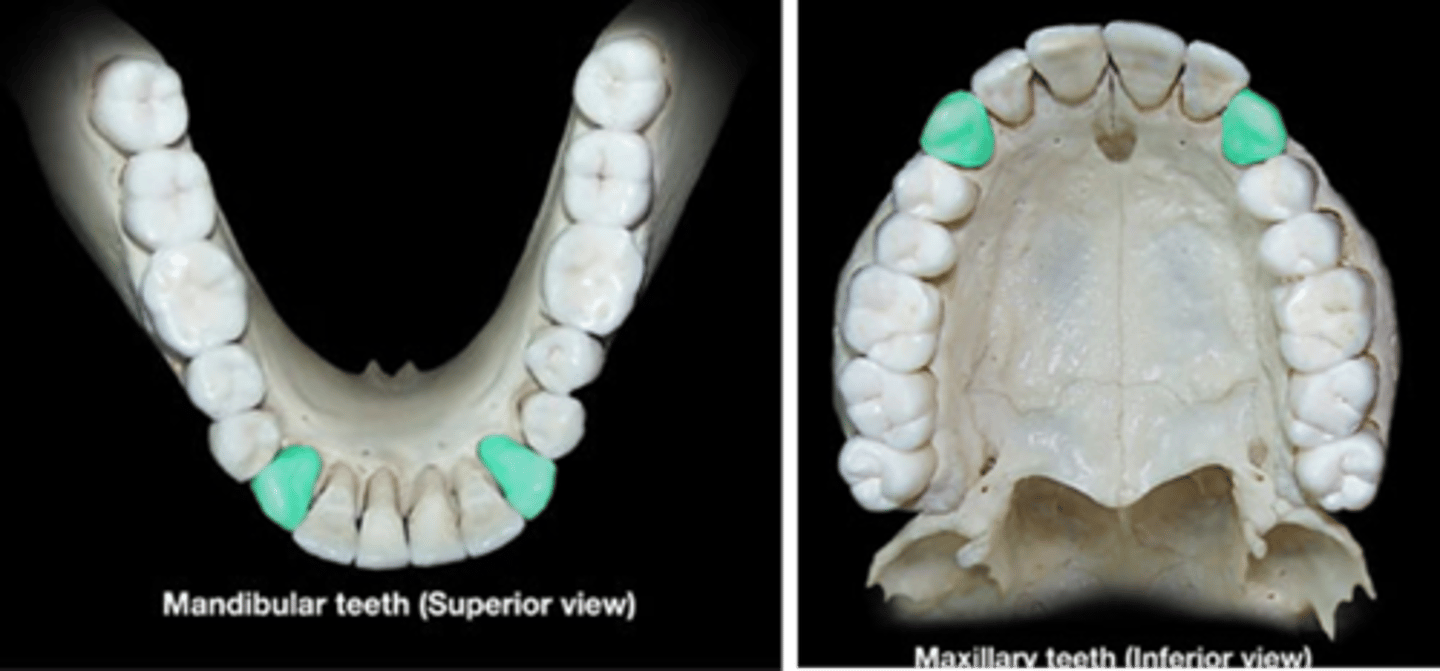 <p>What type of teeth are these which are also known as cuspids?</p>