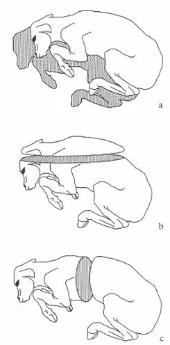 <p>Mid-sagittal section for crown-rump length</p><p>Horizontal section for biparietal distance</p><p>Transverse section for trunk diameter</p>