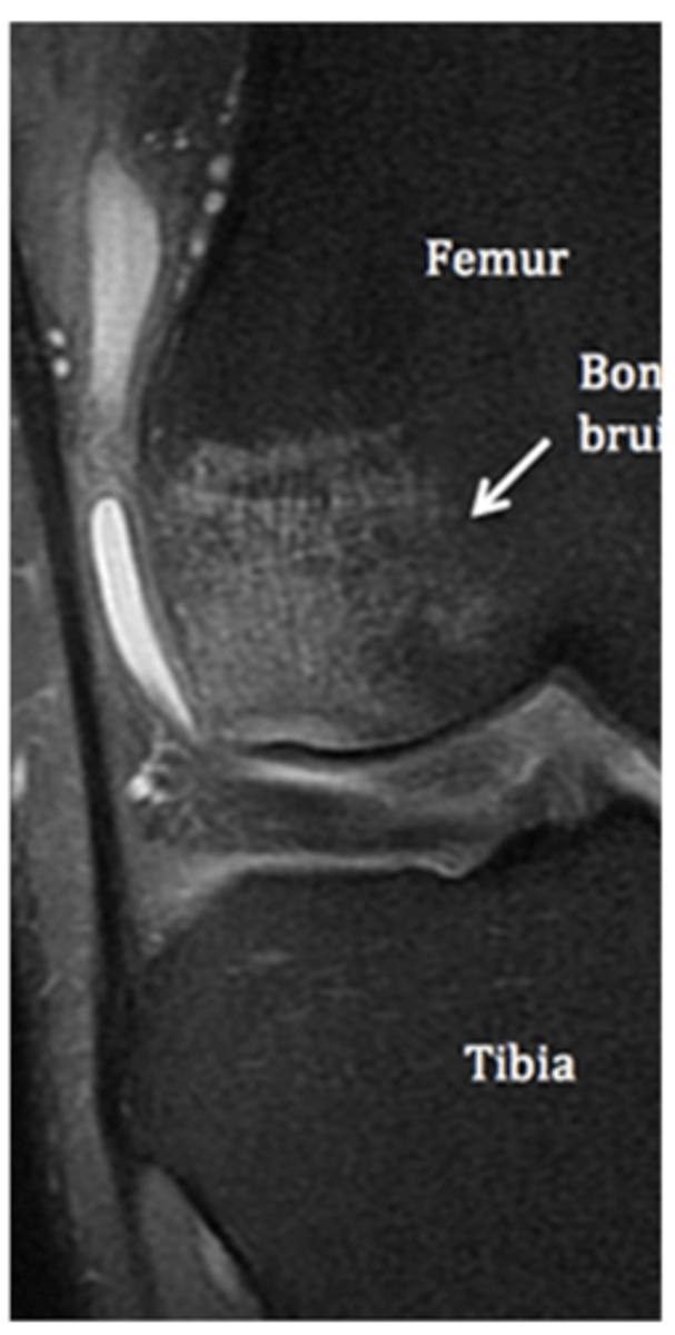 <p>Define the pathology.</p>