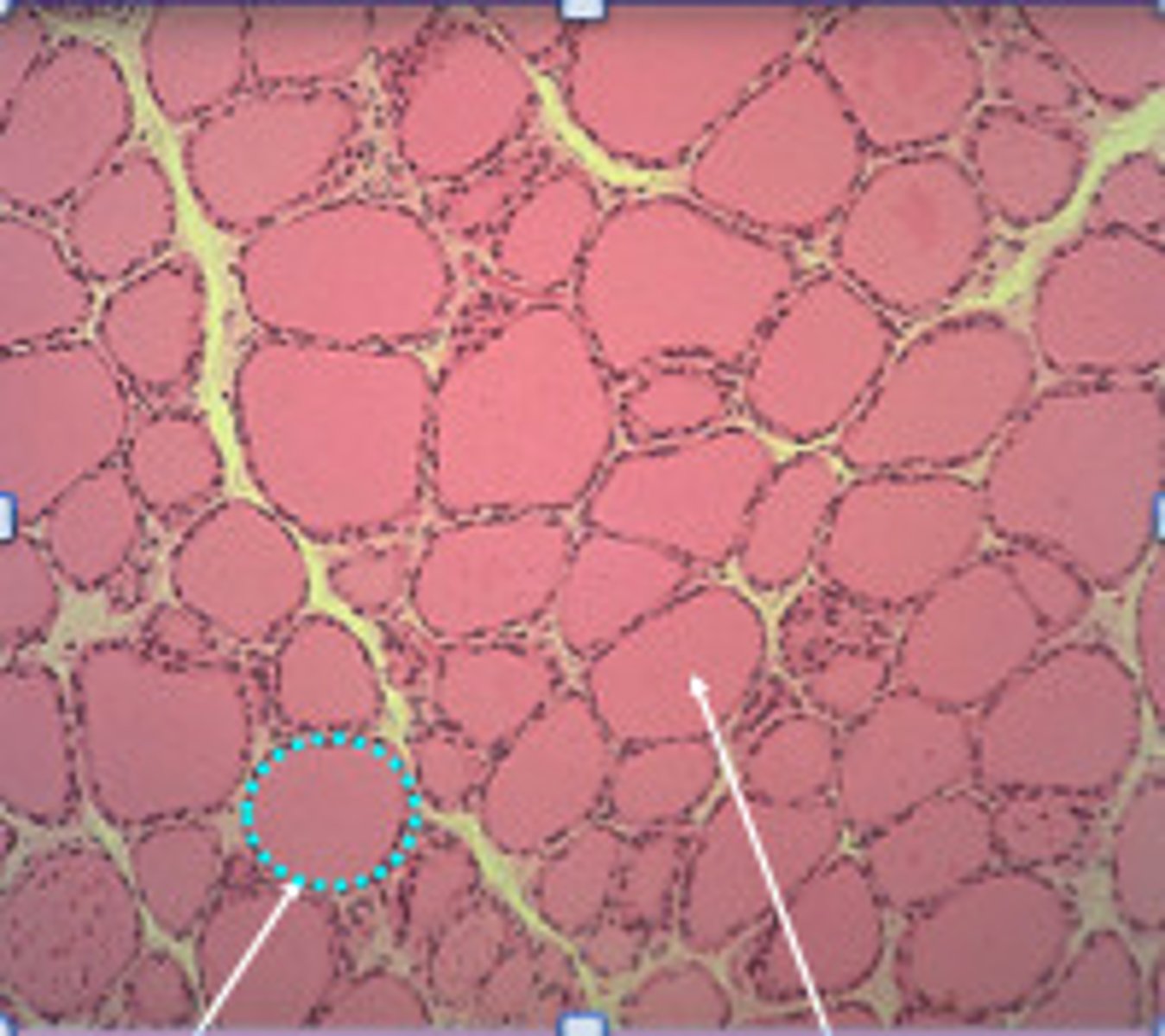 <p>thyroid hormone secretory cells -- produces T3 and T4</p><p>- forms spheres that surround inner lumen (which is acellular - no cells and consists of a colloid (thick fluid))</p>