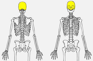 What bone is highlighted?