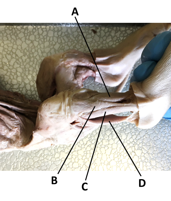 <p><span><span>Identify the muscle labeled with the letter D.</span></span></p>