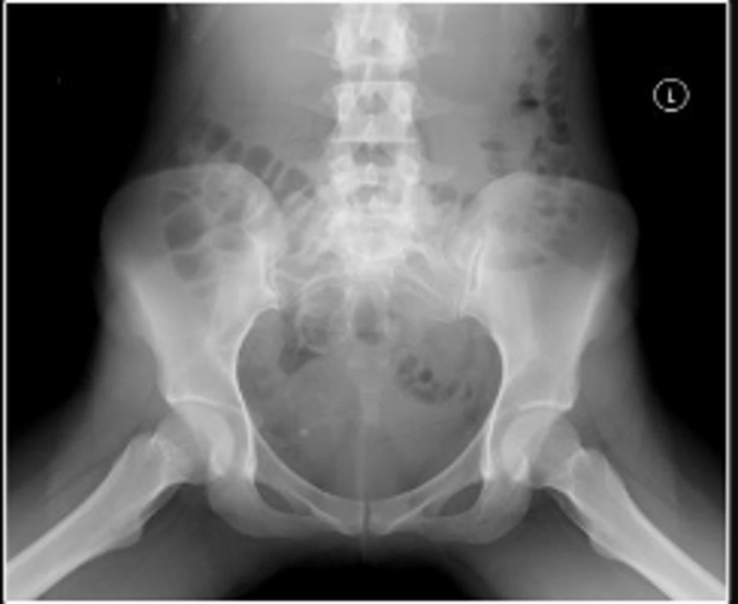 <p>What is the name of the radiographic view?</p>