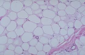 <p>Matrix as in areolar, but very sparse; closely packed adipocytes, or fat cells, have</p><p class="p1">nucleus pushed to the side by large fat droplet.</p><p class="p1">-Provides reserved food fuel; insulates against heat loss; supports and protects organs.</p><p class="p1">-under skin, within abdomin, breast</p>
