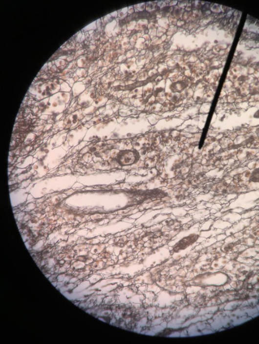 <p>(darker stain)</p>