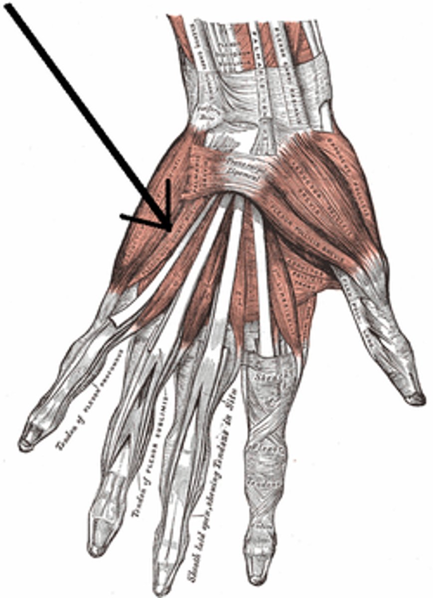 <p>carpal bones</p>