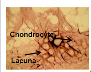 <p>structure: chondrocytes in a matrix of mainly elastic tissue</p><p>function: gives support while remaining flexible</p><p>location: larynx, nose, external ear</p>