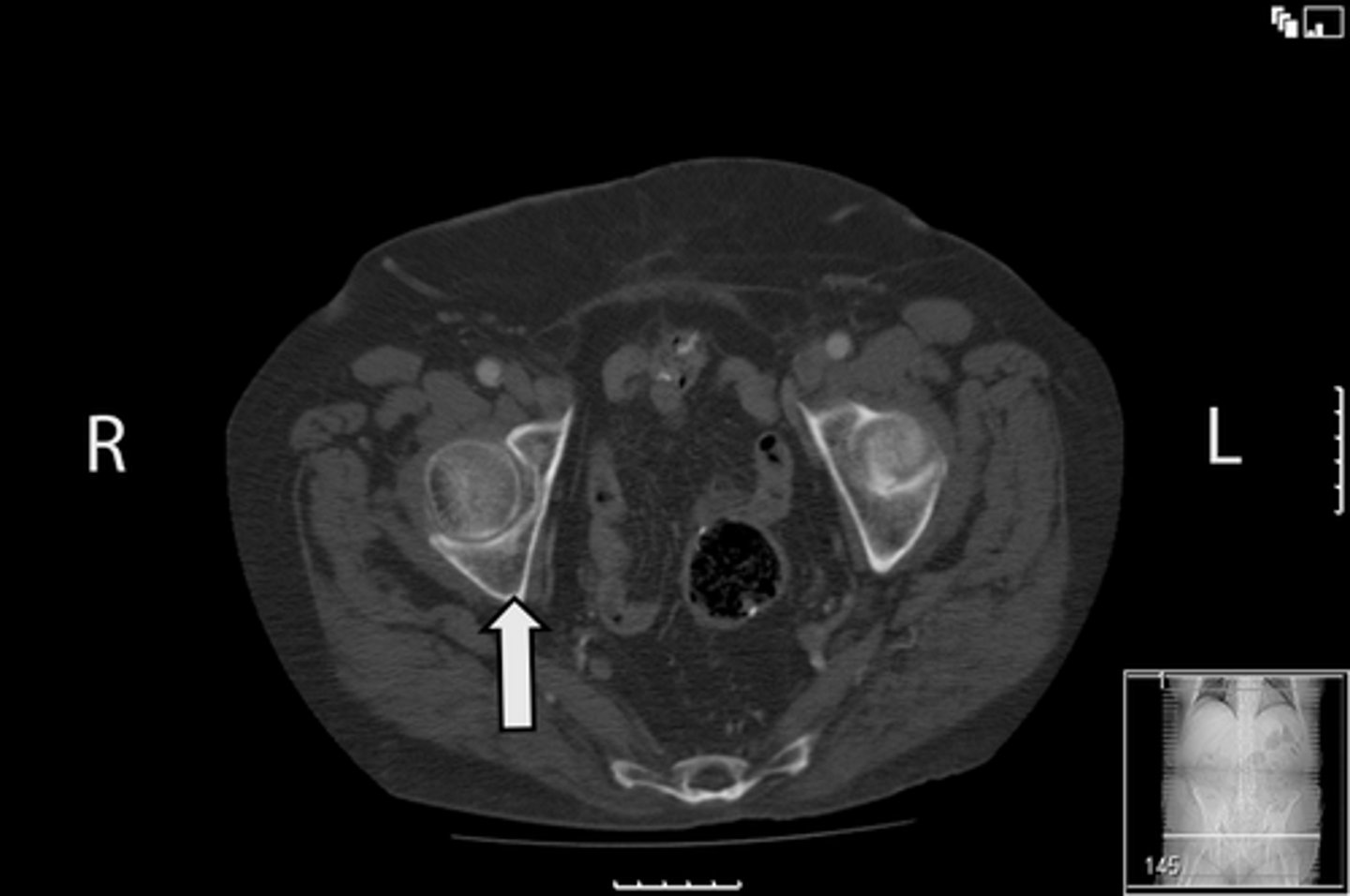 <p>What is indicated in the image?</p>