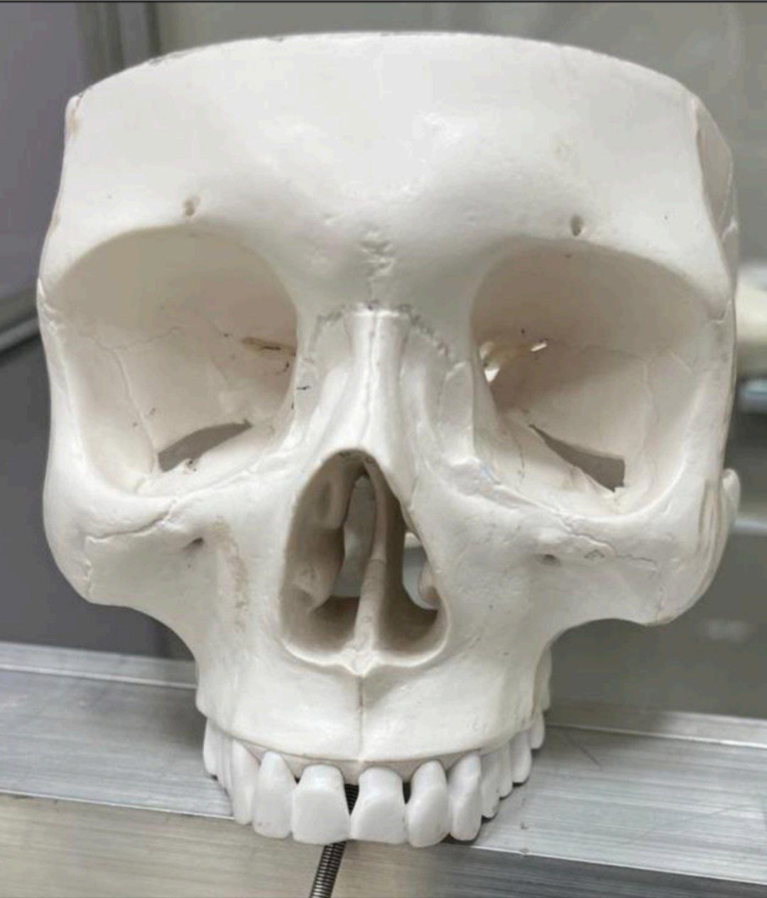 <p>Identify the bone, and classify it according to position and shape.</p>