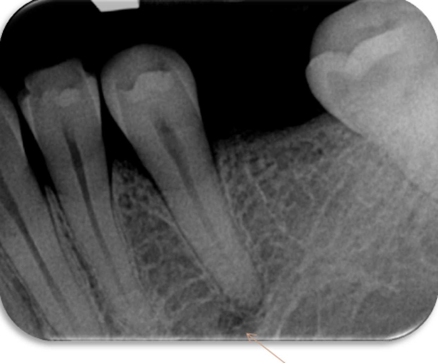 <p>ID the structure:</p>