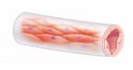 <p>Capillaries</p>