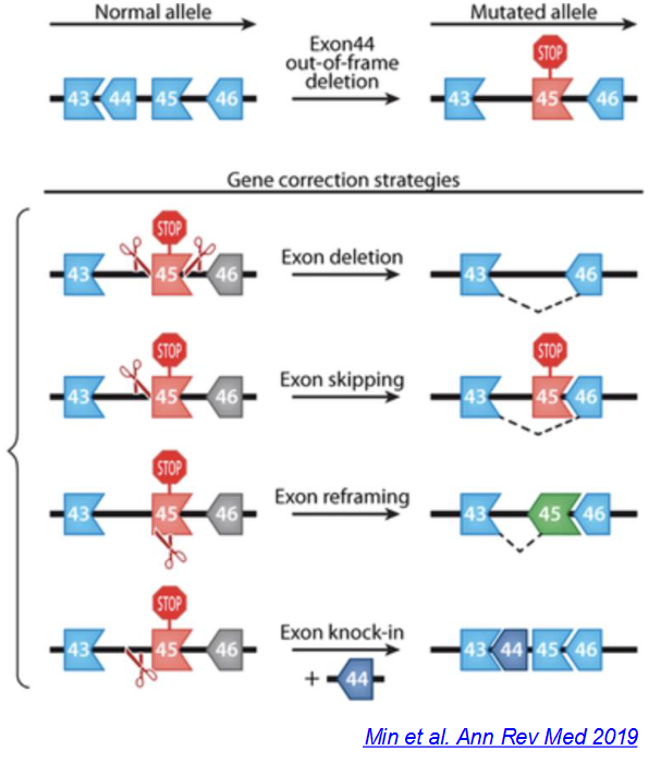 <p>Duchenne muscular dystrophy</p><ul><li><p>Caused by mutations in the X-linked dystrophin gene, disproportionately affecting 1 in 5000 boys worldwide</p></li><li><p>The allele for dystrophin (43-44-45-46) has an exon 44 frameshift deletion that results in a mutated allele with exon 44 deleted and&nbsp;a nonsense mutation in exon 45 (43-__-<span style="color: red;"><strong>45</strong></span>-46)</p></li></ul><p></p><p>Gene correction strategies:</p><ul><li><p>Deletion of exon 45 (43-__-__-46)</p></li><li><p>Skipping of exon 45 (43-__-<span style="color: red;"><s>45</s></span>-46)</p></li><li><p>Reframing of exon 45 (43-__-<span style="color: green;"><strong>45</strong></span>-46)</p></li><li><p>Knock-in of exon 44 (43-<span style="color: green;"><strong>44</strong></span>-<span style="color: green;"><strong>45</strong></span>-46)</p></li></ul><p></p>