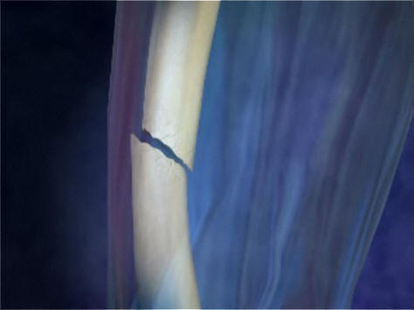 <p>skin remains closed or intact</p>