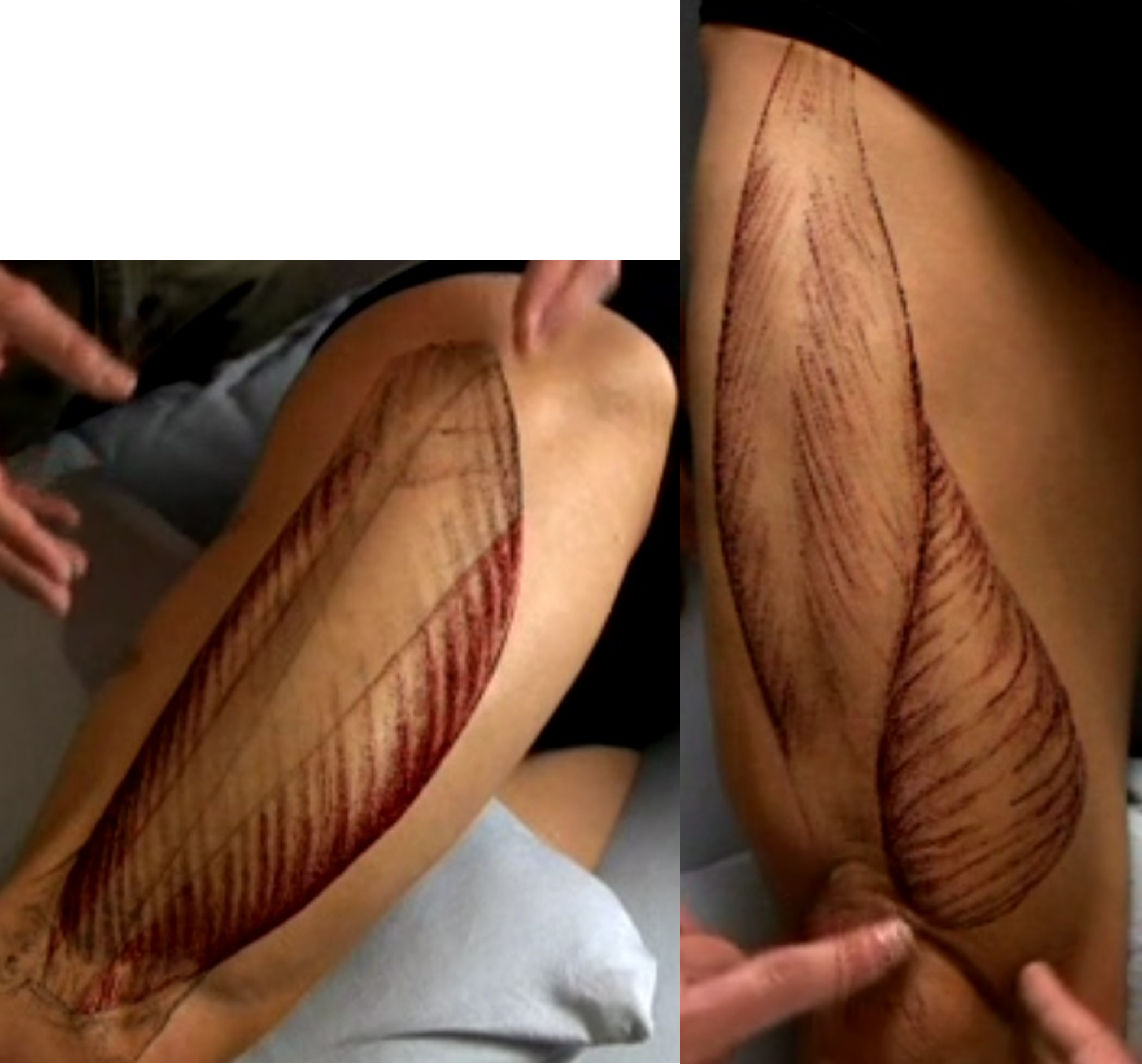 <p>Identify the vastus medialis muscle </p>