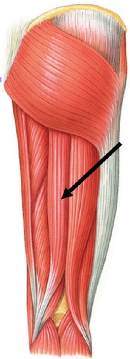 <p>ischial tuberosity</p>