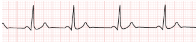 <p>Identify the rhythm! Discuss nursing and collaborative care</p>