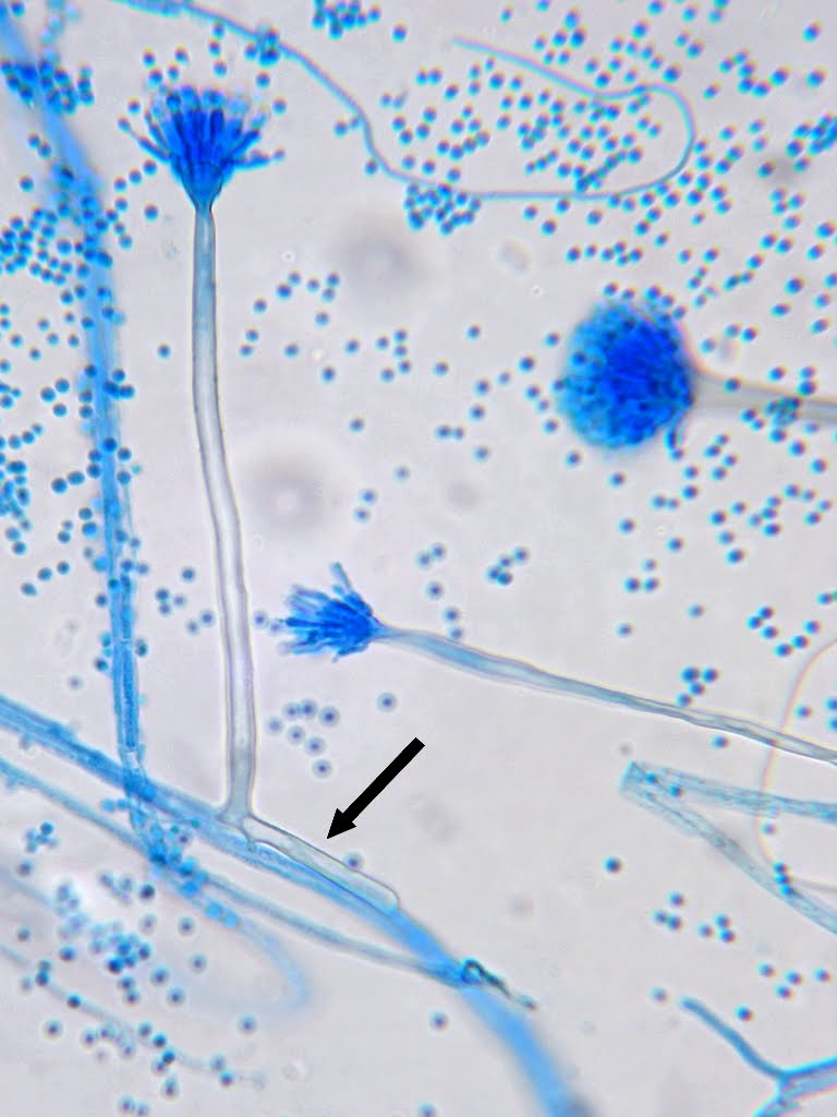 <p><strong>__________</strong>:</p><ul><li><p>The basal cells of conidiophores that anchor them to the vegetative mycelium.</p></li><li><p>Example: Found in molds like <em>Aspergillus</em>.</p></li></ul><p></p><p><strong>Specialized Hyphal Structures</strong></p><p>Molds have evolved specialized hyphal structures to support their growth and reproduction:</p>