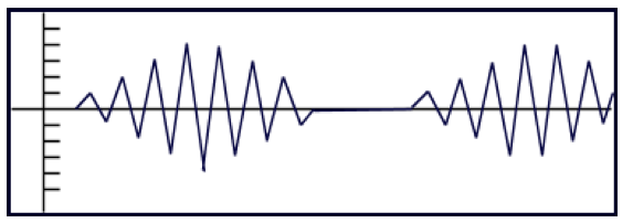 <p><strong>1) Cheyne-Stokes Respiration:</strong></p><ul><li><p>Periods of respiration during which the total volume of a breath becomes shallow, then gets progressively deeper, then gets progressively SHALLOWER again</p></li><li><p>Followed by periods of significant apnea (see image)&nbsp;</p></li></ul><p></p><p><strong>2) Biot’s Respiration:</strong></p><ul><li><p>Periods or&nbsp;“clusters” of rapid respiration of near-equal depth, followed by regular periods of apnea&nbsp;</p></li></ul><p></p><p><strong>3) Apneustic Respiration:</strong></p><ul><li><p>Prolonged inspiratory phase, followed by a prolonged expiratory phase</p></li><li><p>Commonly believed to be apneic phases&nbsp;</p></li></ul><p></p><p><strong>4) Ataxic Respiration:</strong></p><ul><li><p>Completely irregular breathing pattern</p></li><li><p>Increasing episodes of apnea&nbsp;</p></li></ul><p></p>