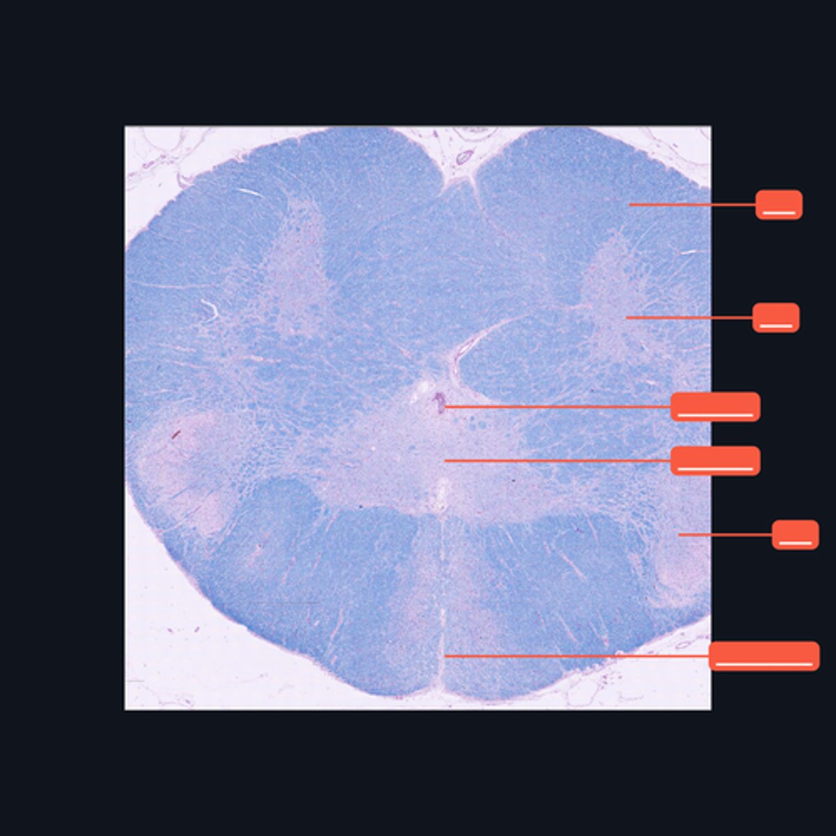 <p>Identify the structures found in the upper cervical region of the spinal cord.</p>