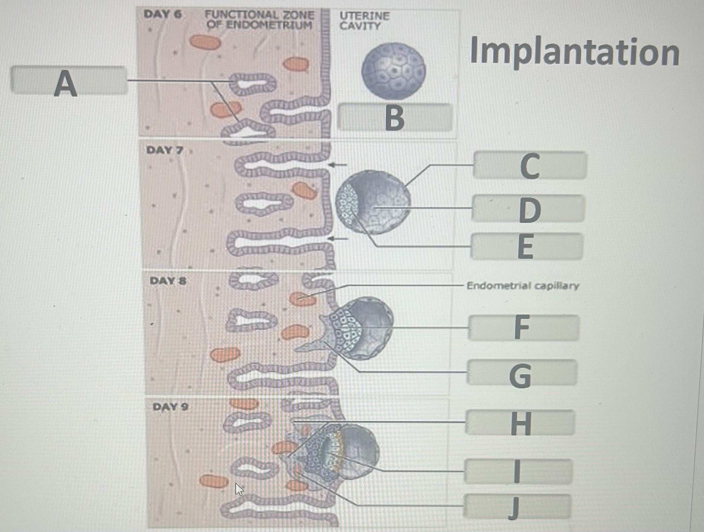Identify the implantation structure labeled F