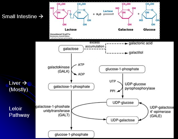 <ul><li><p>Lactose is a disaccharide consisting of galactose and glucose</p><ul><li><p>Must be broken down via galactase to be absorbed</p></li></ul></li><li><p>Galactose must be metabolized into usable glucose forms via Leloir pathway</p><ul><li><p>When Leloir pathway is blocked, there will be accumulation of certain substrates and accumulation of alternative metabolic products</p></li></ul></li></ul><p></p>