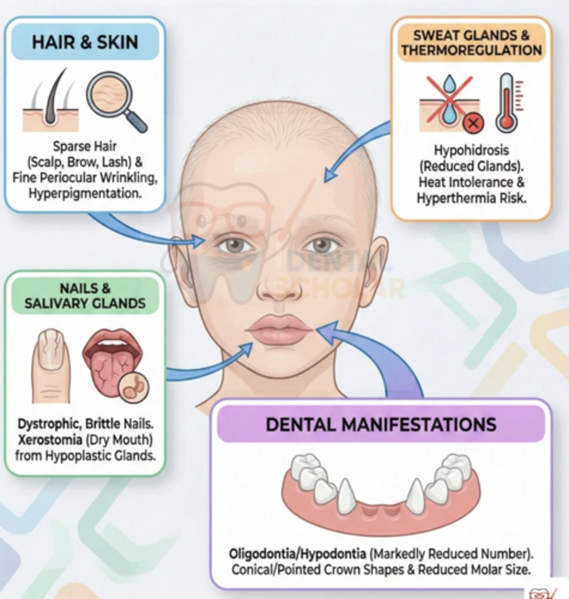 <p>hypo triad: hypohidrosis (decreased sweat glands, heat intolerance), hypotrichosis (fine sparse hair), hypodontia w/ delayed eruption</p><p>-X-linked</p><p>-mid face hypoplasia</p><p>-dystrophic and brittle nails</p><p>-xerostomia</p><p>-fine periocular wrinkling</p><p>-sparse eyelashes and eyebrows</p>