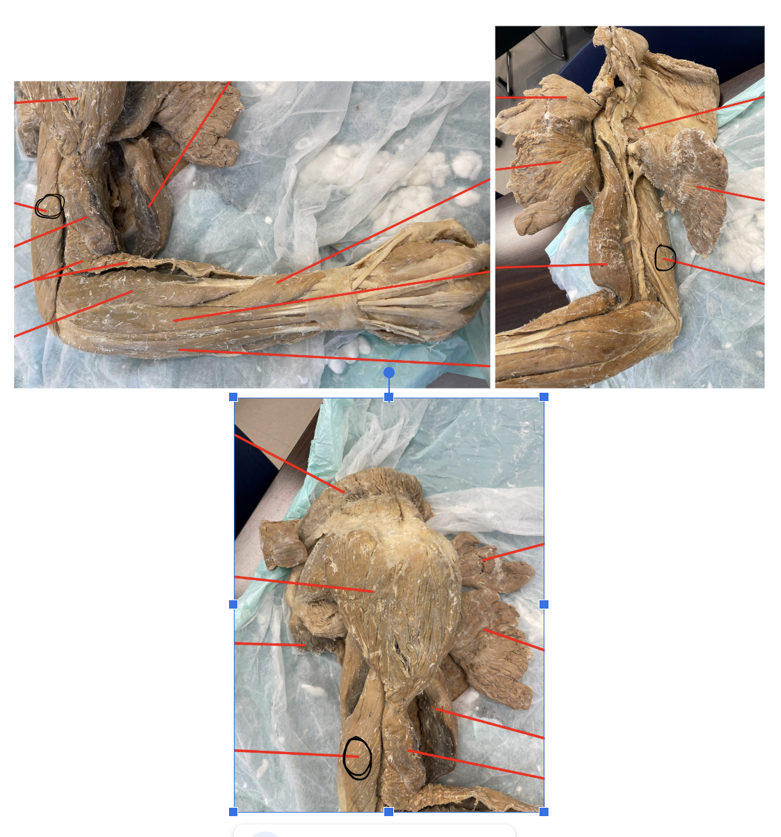 <p>what muscle do the marked images represent?</p>