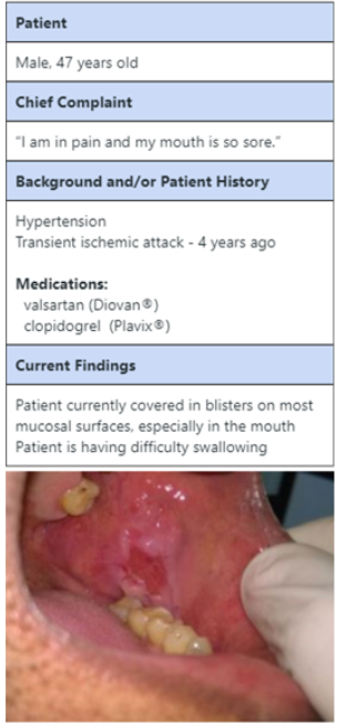 <p>Which of the following is the BEST area for biopsy?</p><p>mucosa on right </p><p>adjacent to ulcer </p><p>no biopsy </p><p>within the biopsy </p>