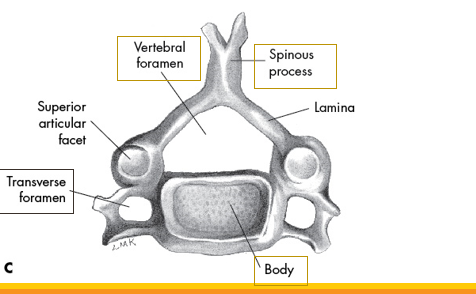 <p>what vertebrae is this</p>