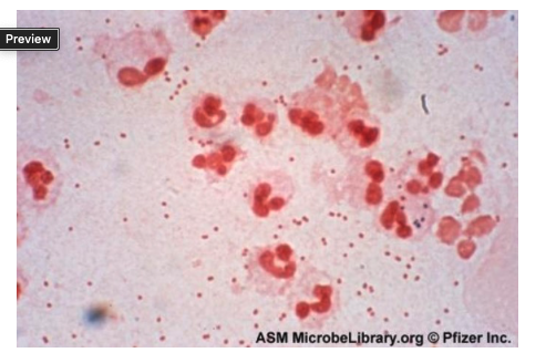 <p>The tests in the previous question were both positive (oxidase and butyrate esterase test).&nbsp;What is the presumptive identification of the organism?</p><p>&nbsp;</p><p>Staphylococcus aureus</p><p>&nbsp;</p><p>Pseudomonas spp.</p><p>&nbsp;</p><p>Haemophilus influenzae</p><p>&nbsp;</p><p>Moraxella catarrhalis</p><p></p>