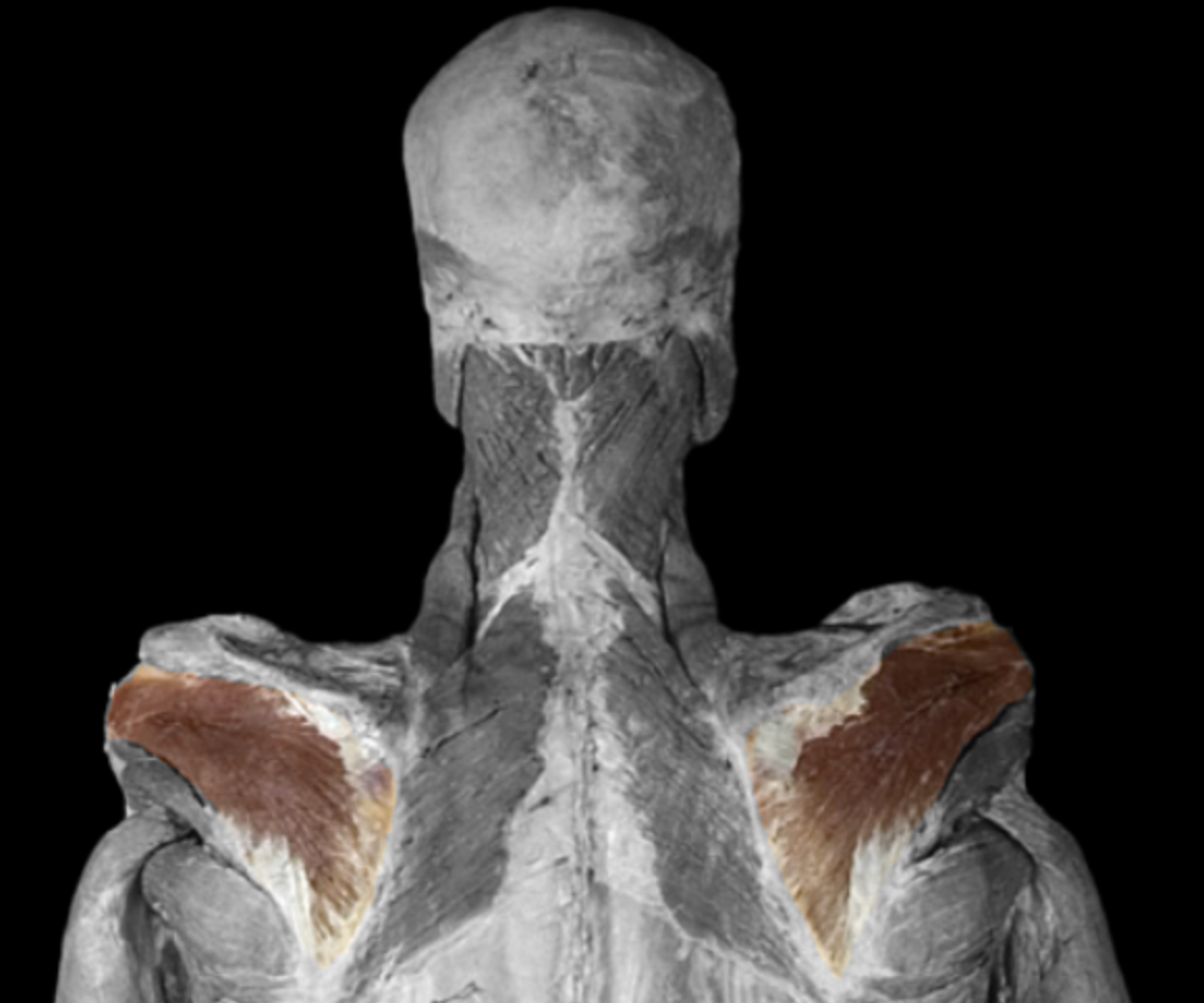 <p>What muscle is this? </p>