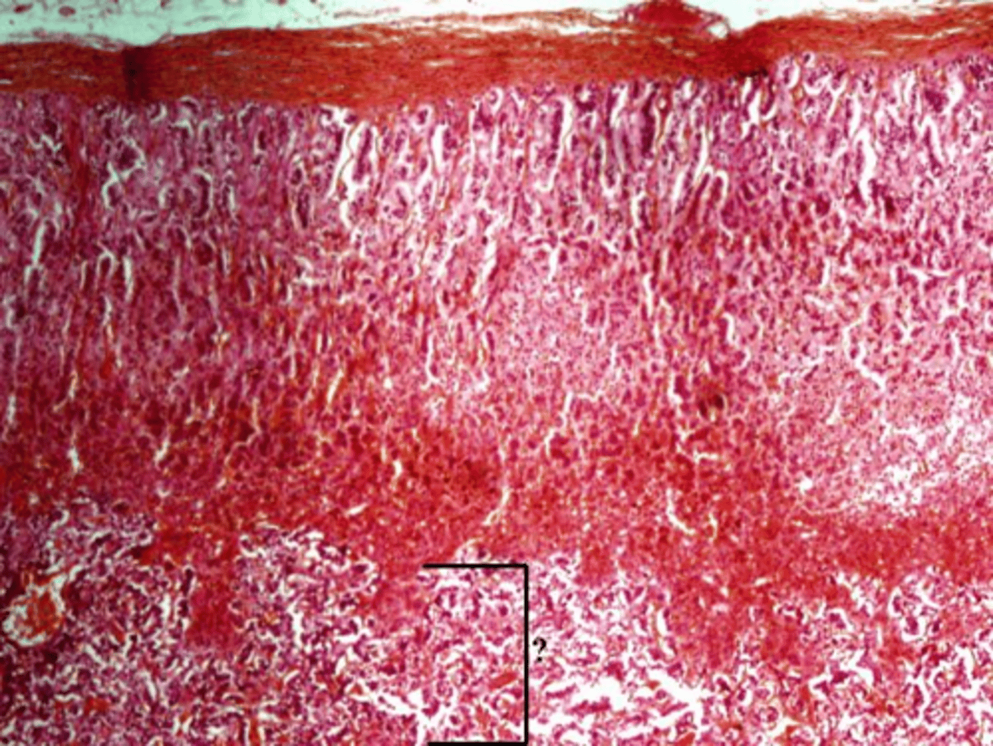 <p>Name a hormone produced by the indicated region of the adrenal gland.</p>