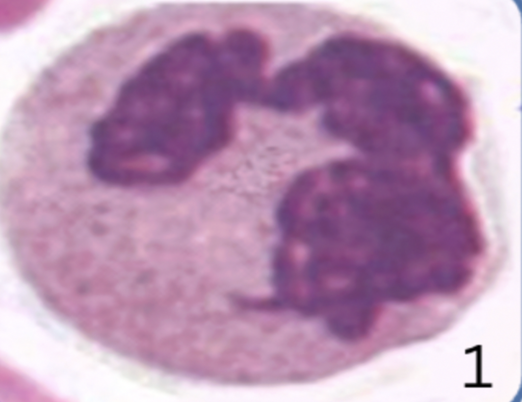 <p><span style="color: purple;"><strong><em><span>Formed Element:</span></em></strong></span> <strong>Neutrophil (leukocyte)</strong></p>