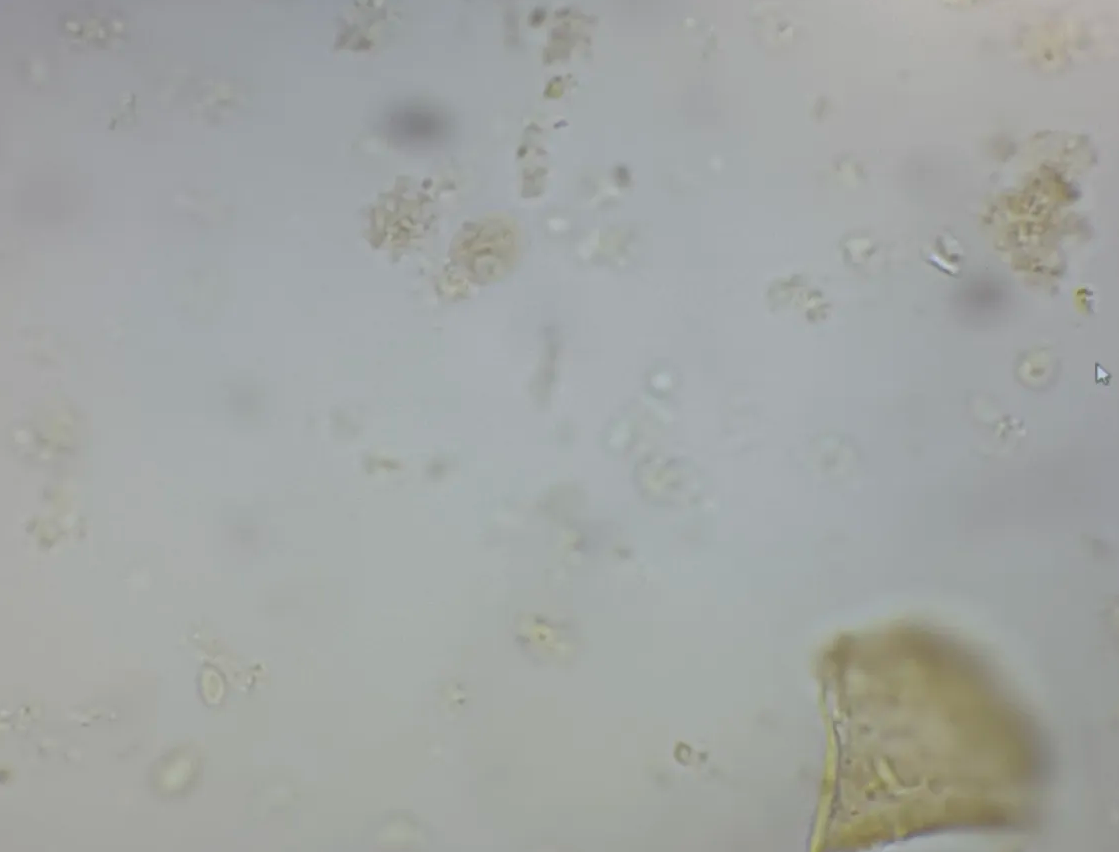 <p>in humans with generic GI problems</p>