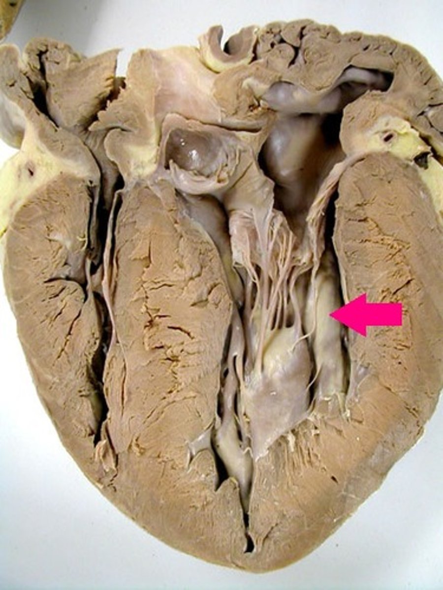 <p>Identify the chamber.</p>