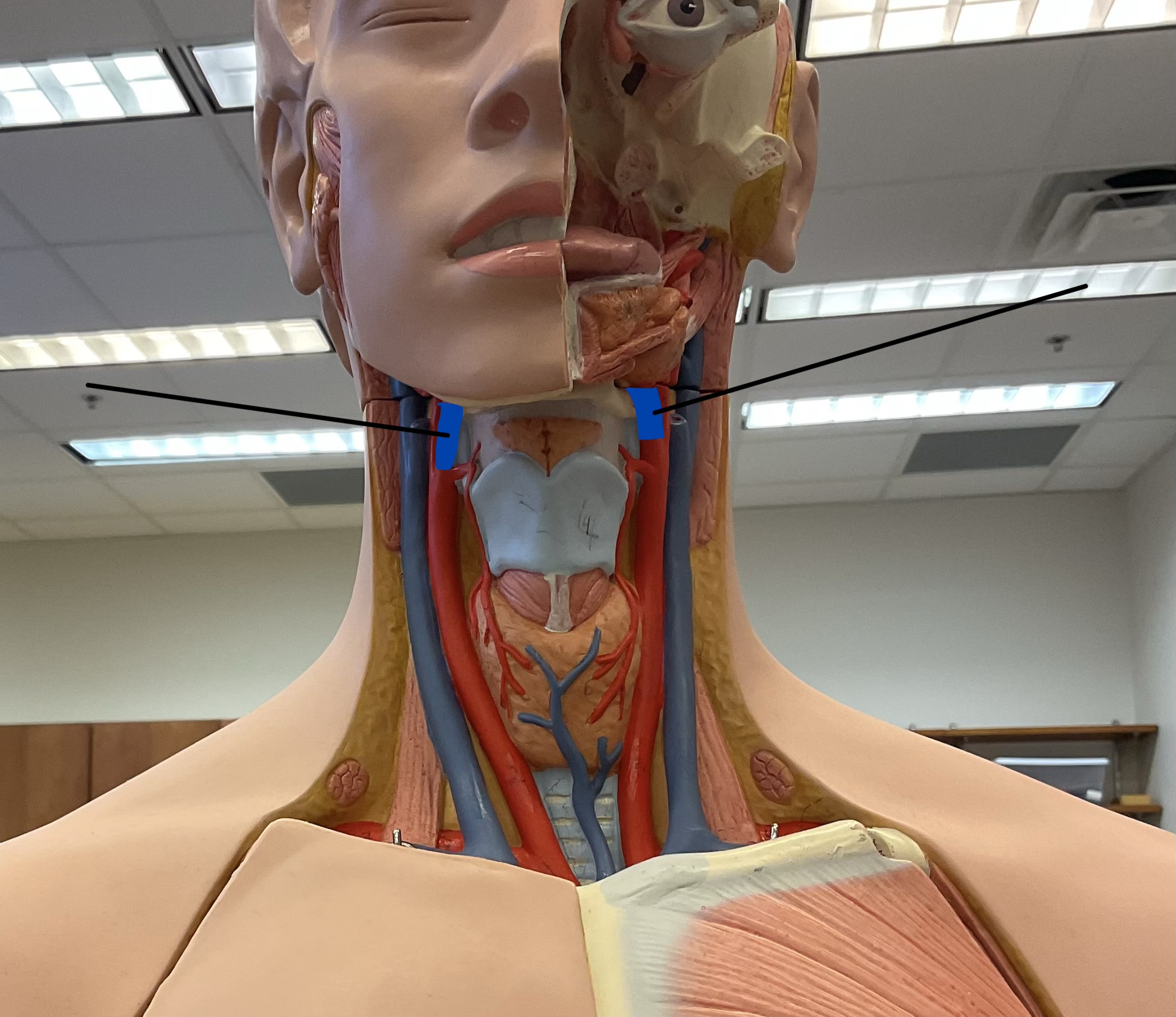 <p>Name these arteries that feeds into the brain.</p>