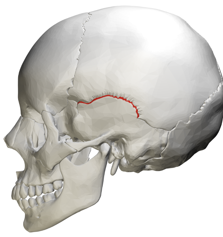 <p>Separates the temporal from the sphenoid, occipital, and parietal </p>