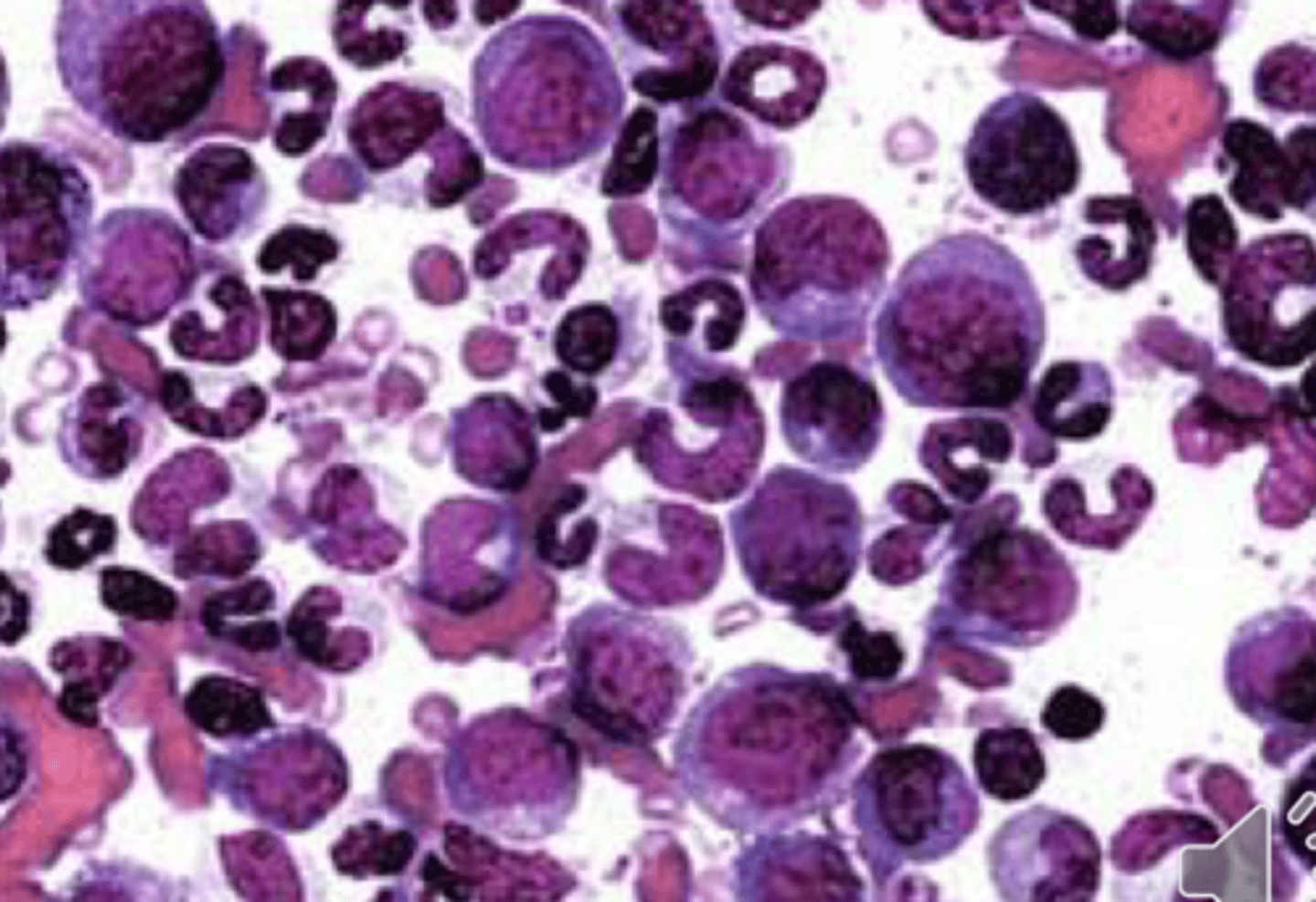 <p>- Cytology (There is individual cell detail, lineage, nuclei, and maturation)</p>