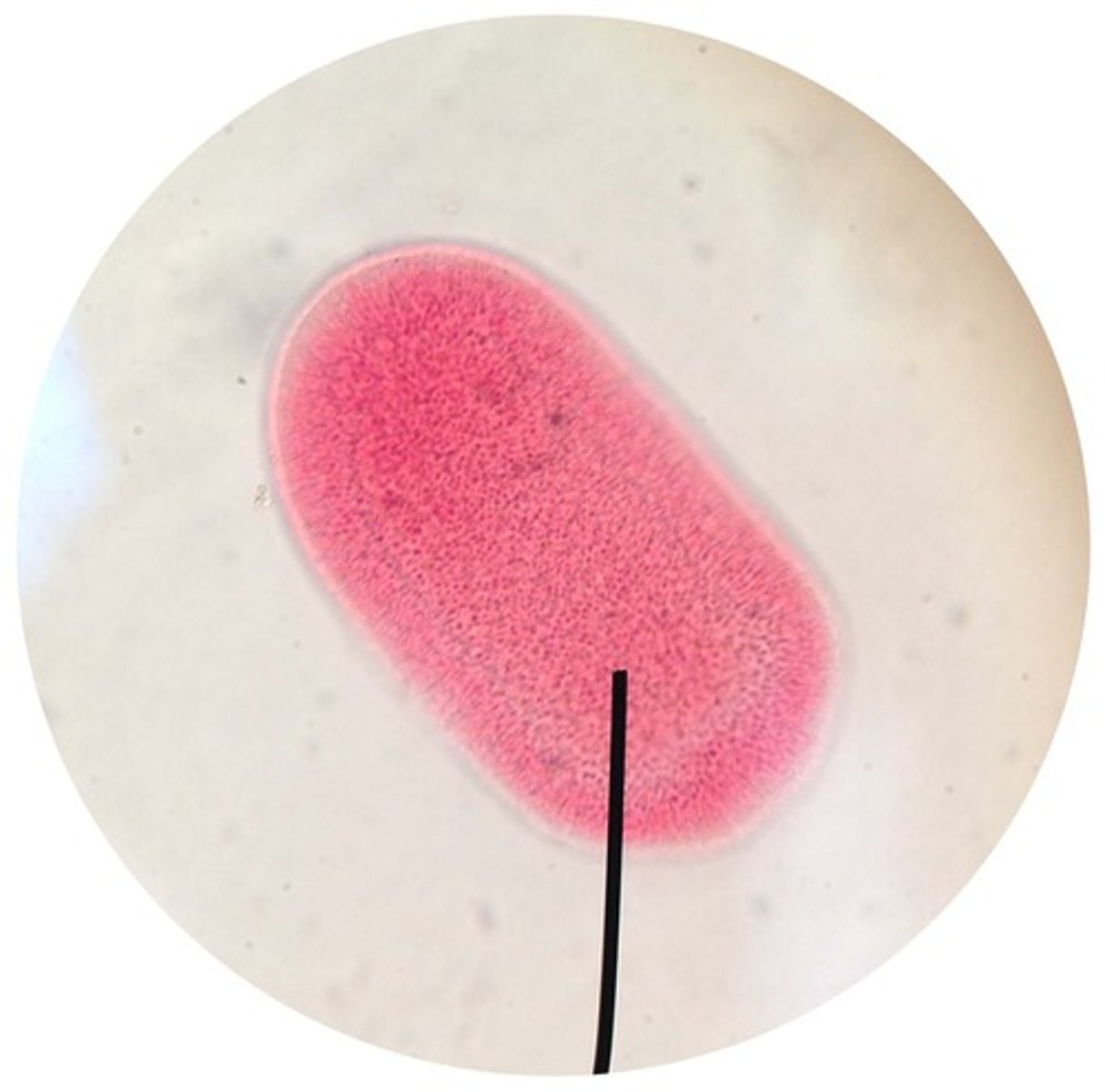 <p>- the free-swimming larval stage that develops after fertilization</p><p>- planula eventually settles on a substrate and develops into the next stage</p>